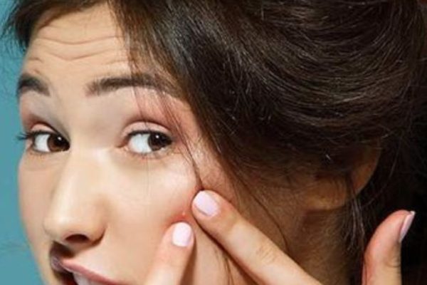 BAD COMMON HABITS THAT DAMAGES OUR SKIN.